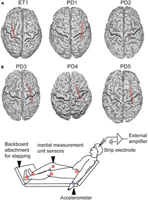 Human upper extremity motor cortex activity shows distinct oscillatory signatures for stereotyped arm and leg movements